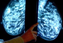 Tens of thousands of Surrey women miss “vital” breast cancer screening