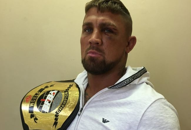 Darren ‘Dazzler’ Hendry with his bareknuckle boxing world title belt